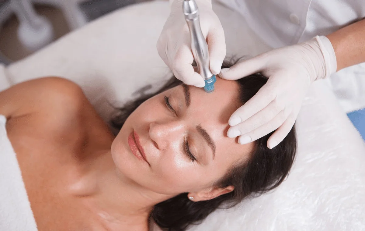 Tratamiento con exosomas facial y capilar