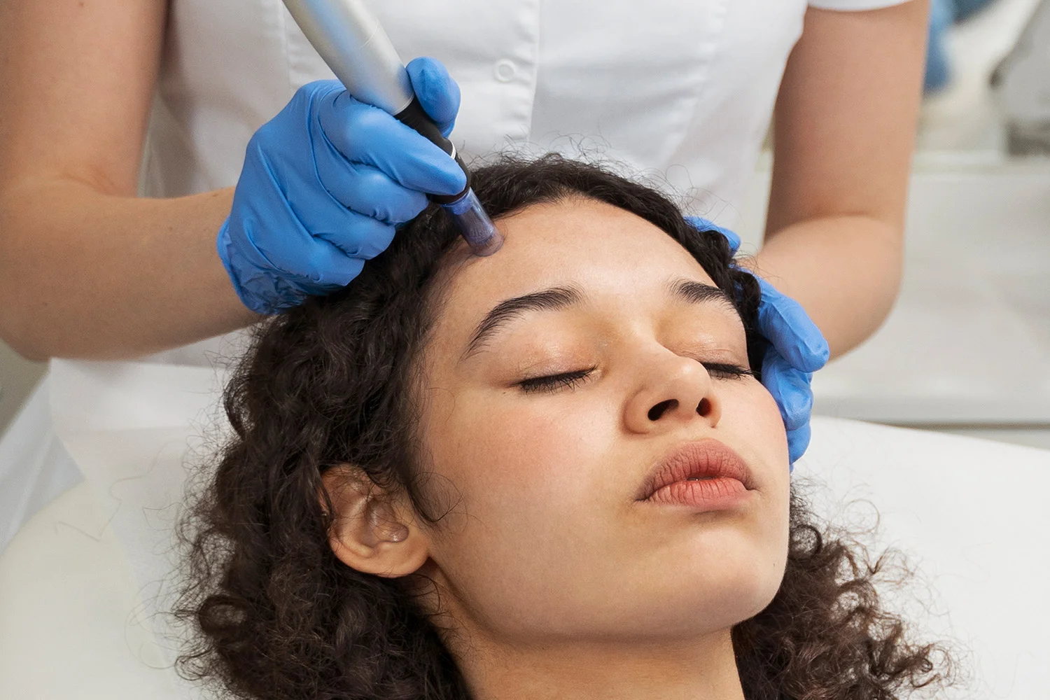 Mesoterapia facial y capilar